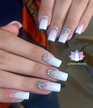 کاشت پلی ژل 